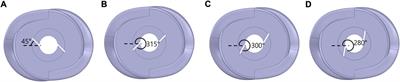 Numerical investigation of losses in a double-suction multistage centrifugal pump and its mitigation using baffle plates